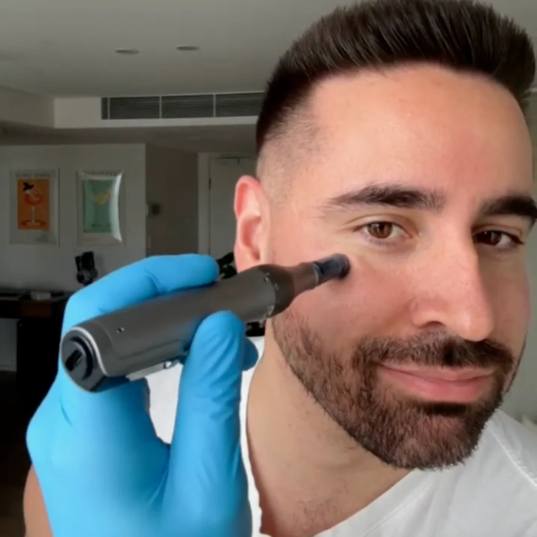 Dr. Pen M8S Microneedling Pen - Image 11