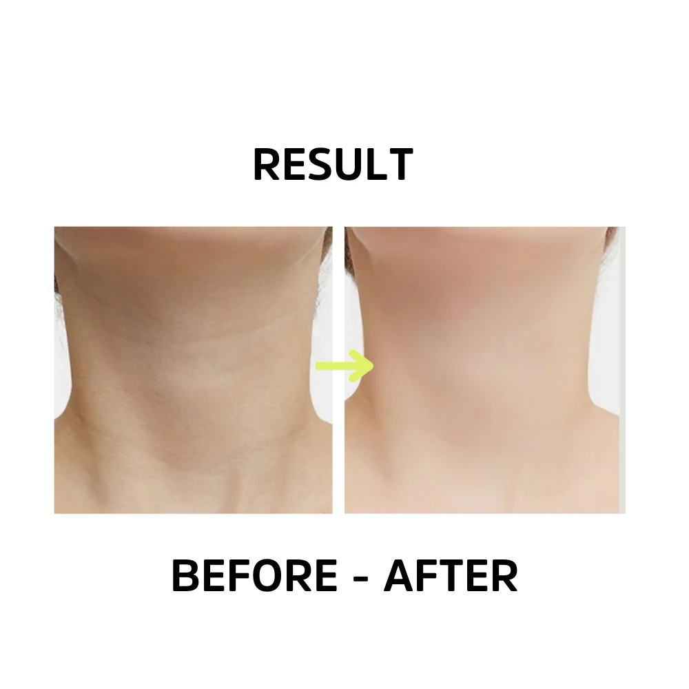 Femvy 3-in-1 Face and Neck Sculpting Tool - Image 8