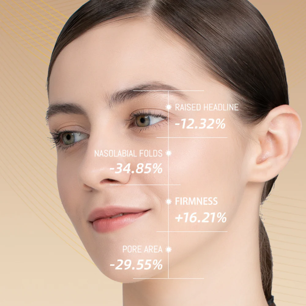 PRO Facial RF Skin Tightening Wand - Image 5
