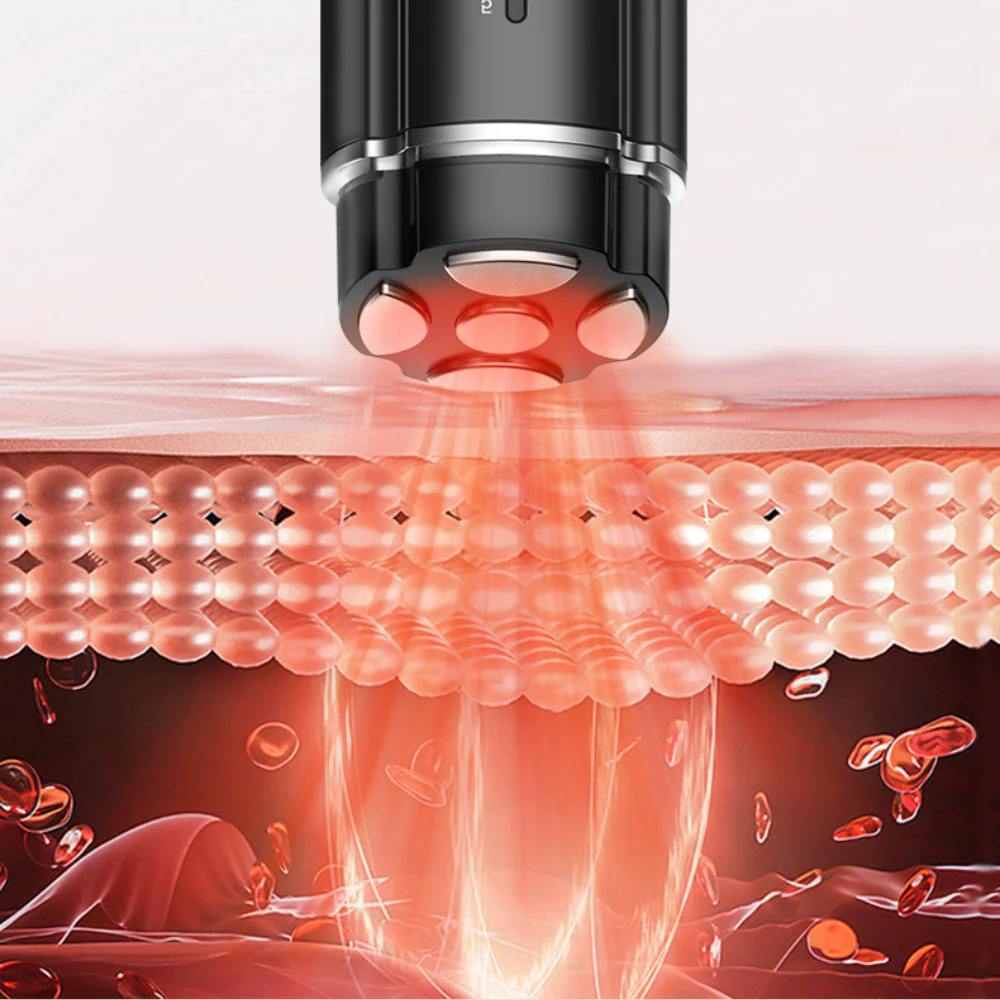 PRO Facial RF Skin Tightening Wand - Image 7
